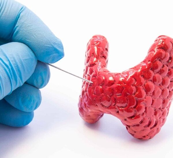 Biopsia de tiroides Quito Dra Karina Aguirre-min